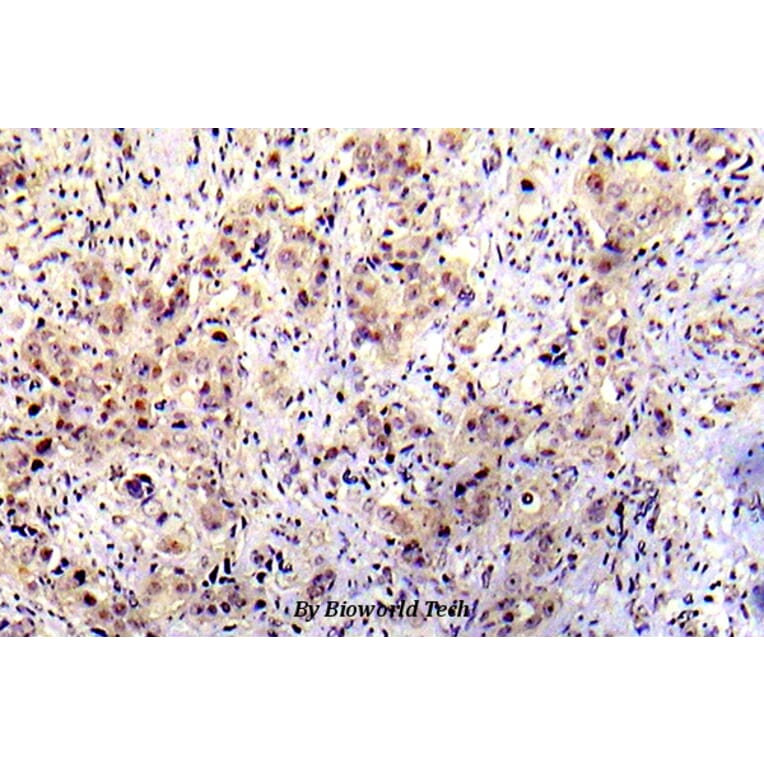 Anti-p53 (phospho-S20) Antibody from Bioworld Technology (BS5027) - Antibodies.com