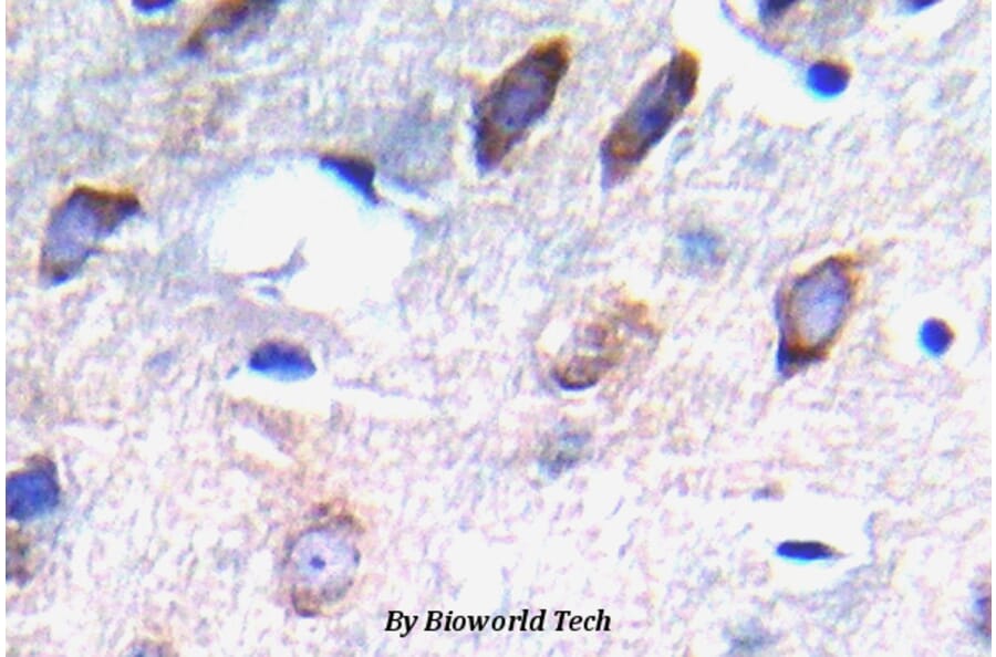Anti-PDGFR-β (phospho-Y751) Antibody from Bioworld Technology (BS5030) - Antibodies.com