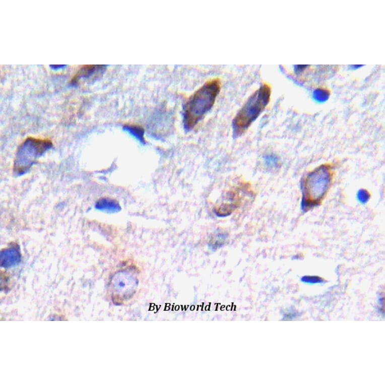 Anti-PDGFR-β (phospho-Y751) Antibody from Bioworld Technology (BS5030) - Antibodies.com