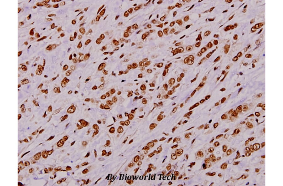 Anti-Stat1 (phospho-S727) Antibody from Bioworld Technology (BS5036) - Antibodies.com