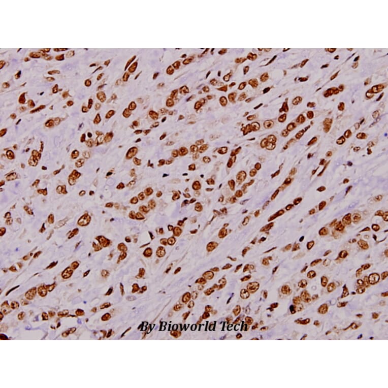 Anti-Stat1 (phospho-S727) Antibody from Bioworld Technology (BS5036) - Antibodies.com