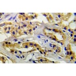 Anti-VEGFR2/Flk-1 (phospho-Y1214) Antibody from Bioworld Technology (BS5040) - Antibodies.com