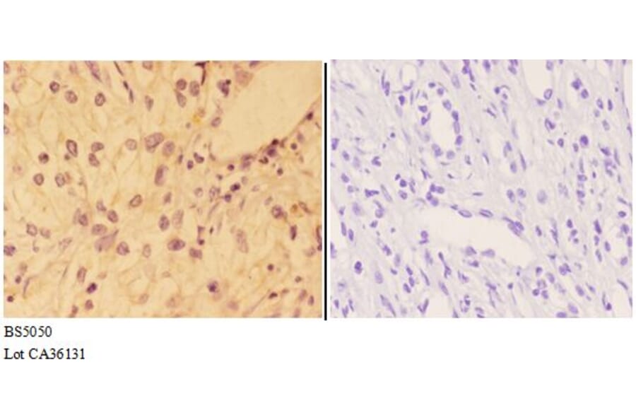 Anti-AKT (phospho-Y326) Antibody from Bioworld Technology (BS5050) - Antibodies.com