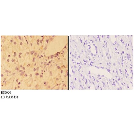Anti-AKT (phospho-Y326) Antibody from Bioworld Technology (BS5050) - Antibodies.com