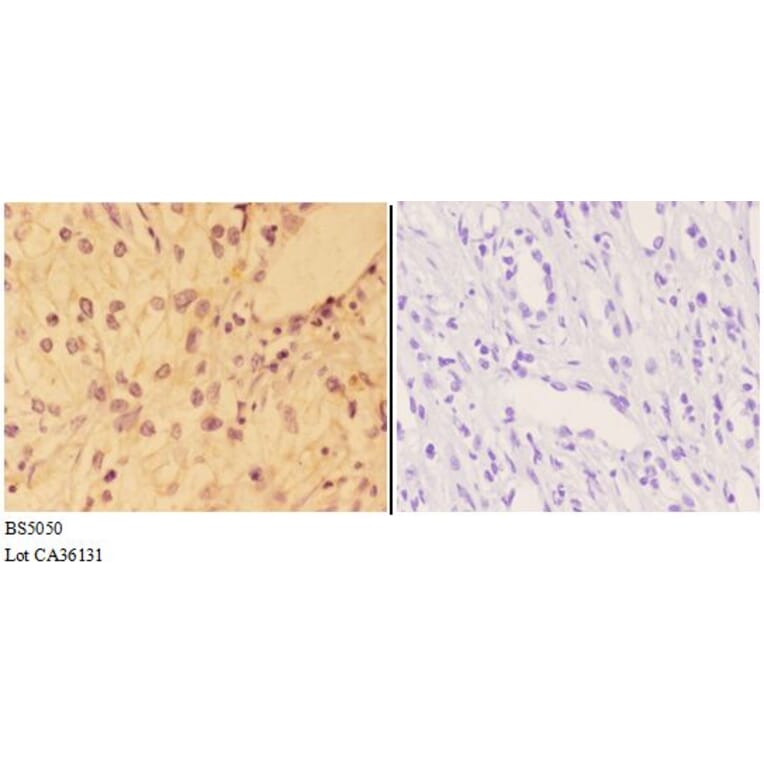 Anti-AKT (phospho-Y326) Antibody from Bioworld Technology (BS5050) - Antibodies.com