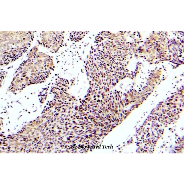 Anti-ASK1 (phospho-S83) Antibody from Bioworld Technology (BS5054) - Antibodies.com