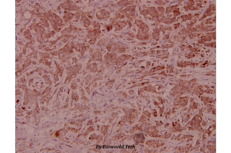 Anti-Catenin-β Antibody from Bioworld Technology (BS5056) - Antibodies.com