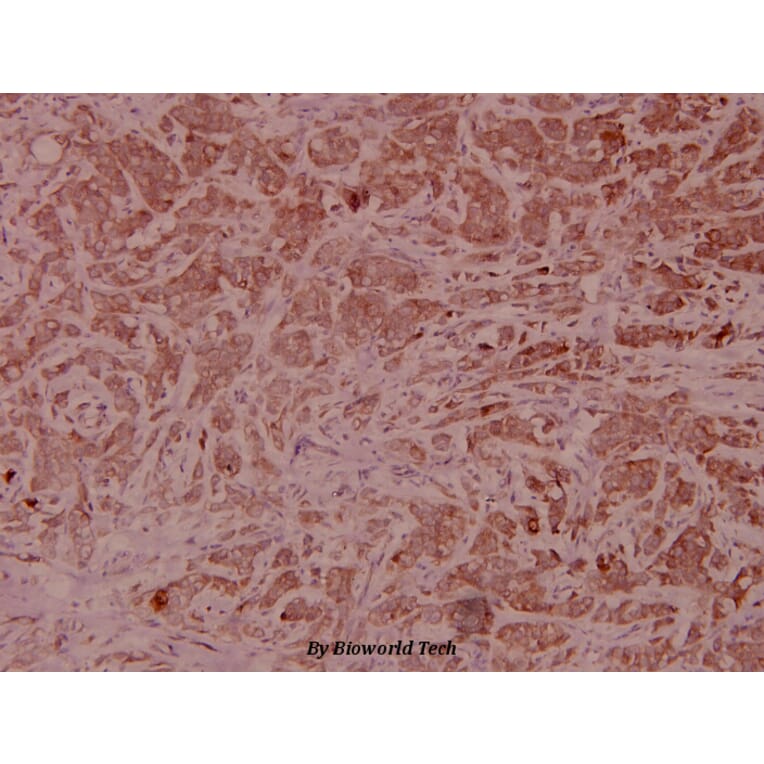 Anti-Catenin-β Antibody from Bioworld Technology (BS5056) - Antibodies.com