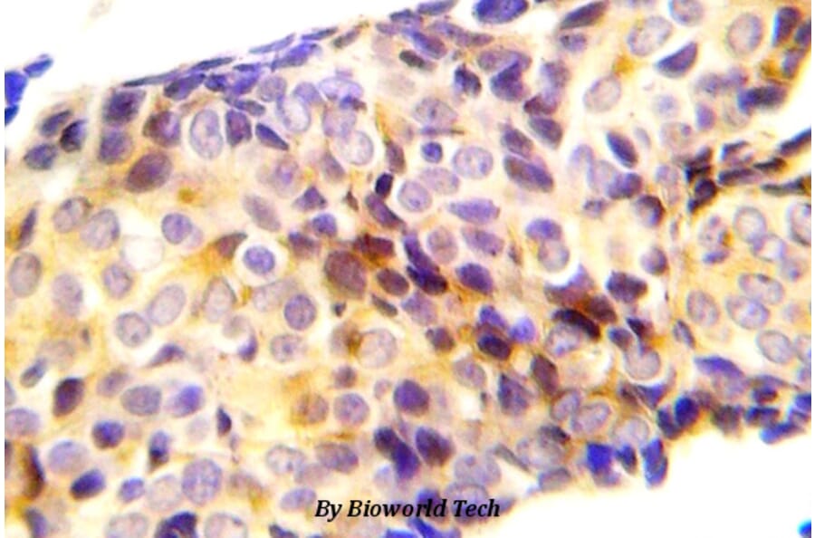 Anti-Catenin-β (phospho-T41/S45) Antibody from Bioworld Technology (BS5057) - Antibodies.com