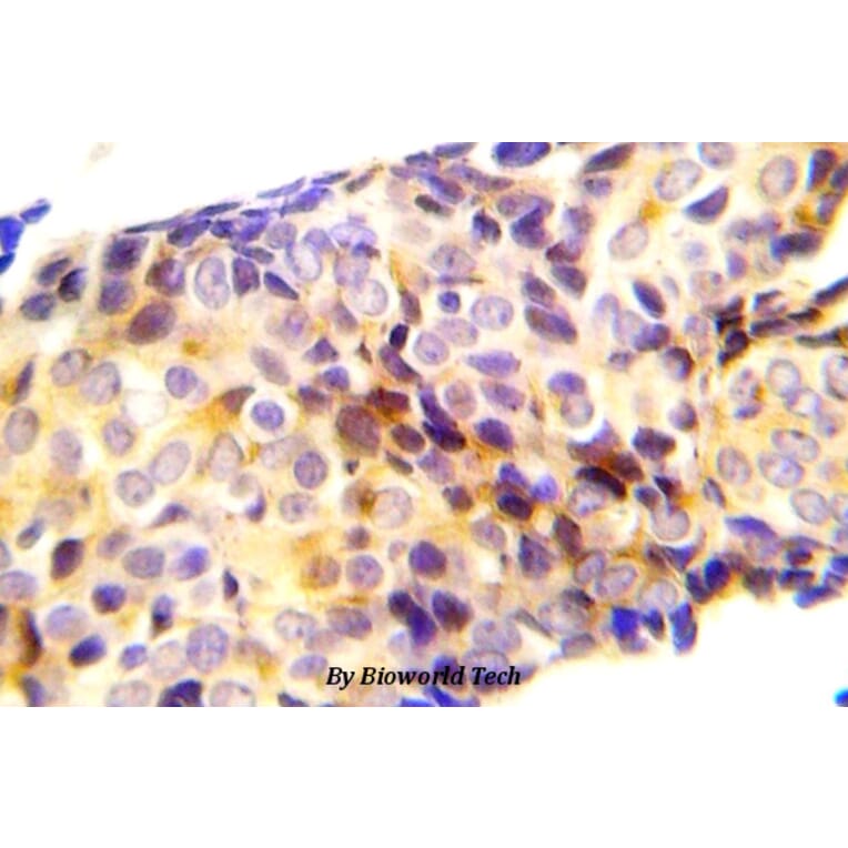 Anti-Catenin-β (phospho-T41/S45) Antibody from Bioworld Technology (BS5057) - Antibodies.com