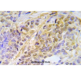 Anti-Chk2 (phospho-T387) Antibody from Bioworld Technology (BS5061) - Antibodies.com