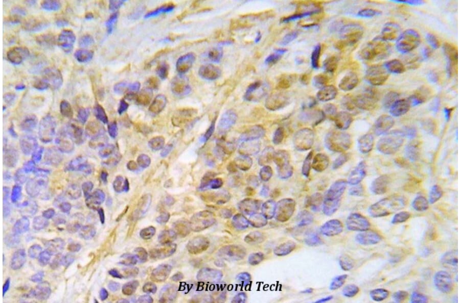 Anti-Chk2 (phospho-T387) Antibody from Bioworld Technology (BS5061) - Antibodies.com