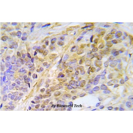 Anti-Chk2 (phospho-T387) Antibody from Bioworld Technology (BS5061) - Antibodies.com
