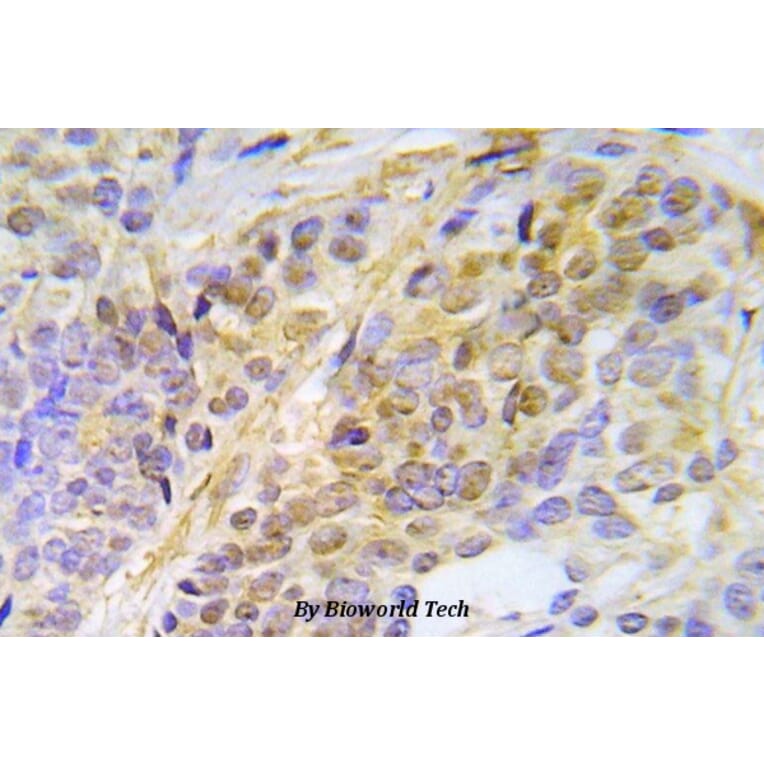 Anti-Chk2 (phospho-T387) Antibody from Bioworld Technology (BS5061) - Antibodies.com