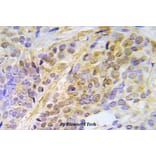 Anti-Chk2 (phospho-T387) Antibody from Bioworld Technology (BS5061) - Antibodies.com
