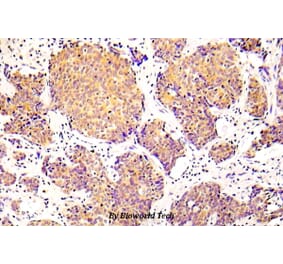 Anti-Cofilin 1 (phospho-S3) Antibody from Bioworld Technology (BS5063) - Antibodies.com