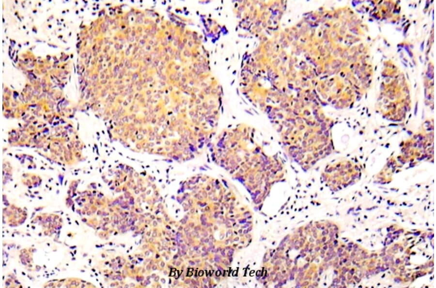 Anti-Cofilin 1 (phospho-S3) Antibody from Bioworld Technology (BS5063) - Antibodies.com