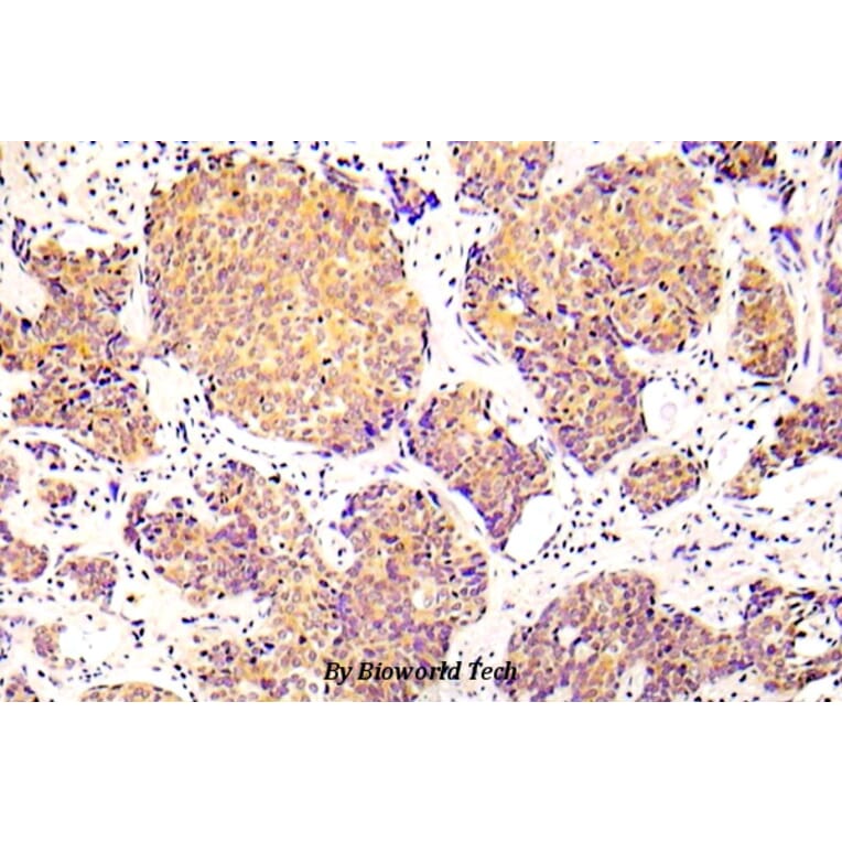 Anti-Cofilin 1 (phospho-S3) Antibody from Bioworld Technology (BS5063) - Antibodies.com