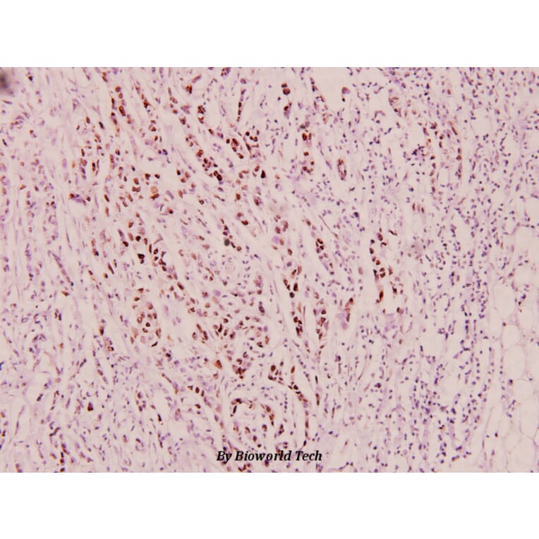 Anti-DNA-PK (phospho-Y2609) Antibody from Bioworld Technology (BS5066) - Antibodies.com