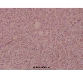 Anti-FGFR1 (phospho-Y154) Antibody from Bioworld Technology (BS5070) - Antibodies.com