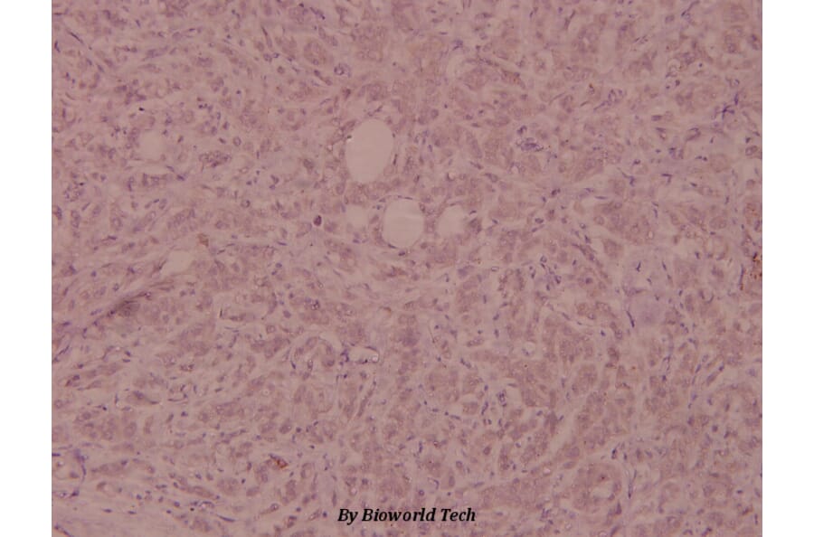 Anti-FGFR1 (phospho-Y154) Antibody from Bioworld Technology (BS5070) - Antibodies.com