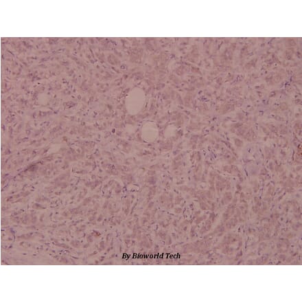 Anti-FGFR1 (phospho-Y154) Antibody from Bioworld Technology (BS5070) - Antibodies.com