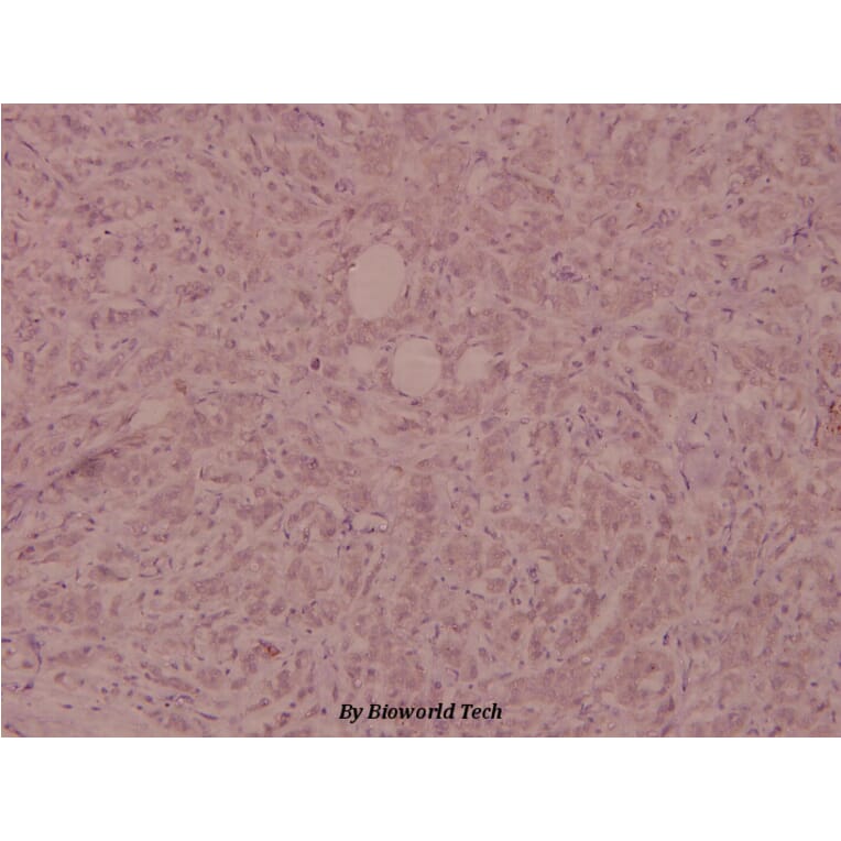 Anti-FGFR1 (phospho-Y154) Antibody from Bioworld Technology (BS5070) - Antibodies.com