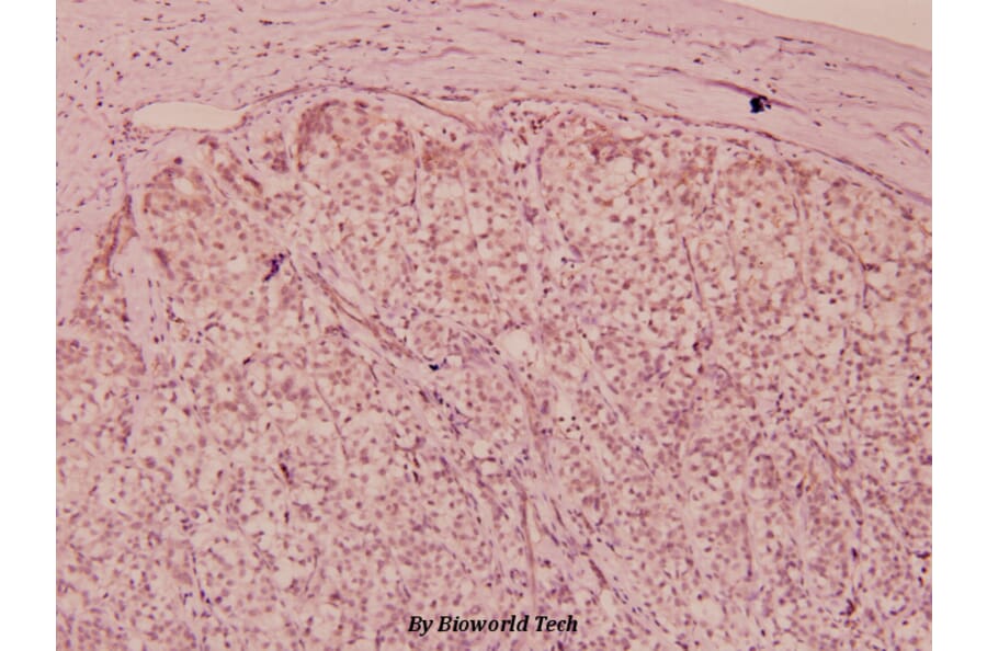 Anti-Flt3 (phospho-Y591) Antibody from Bioworld Technology (BS5071) - Antibodies.com
