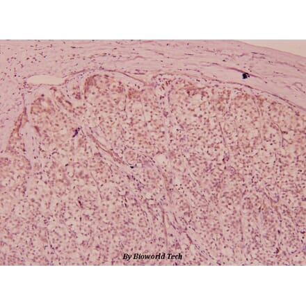 Anti-Flt3 (phospho-Y591) Antibody from Bioworld Technology (BS5071) - Antibodies.com