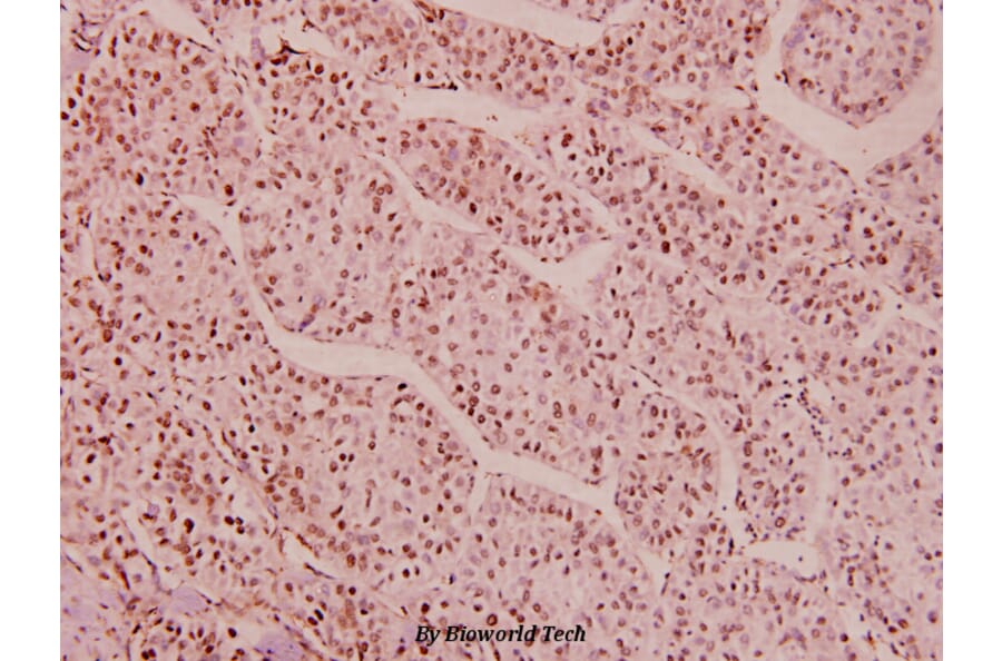 Anti-HDAC1 (phospho-S421/423) Antibody from Bioworld Technology (BS5077) - Antibodies.com
