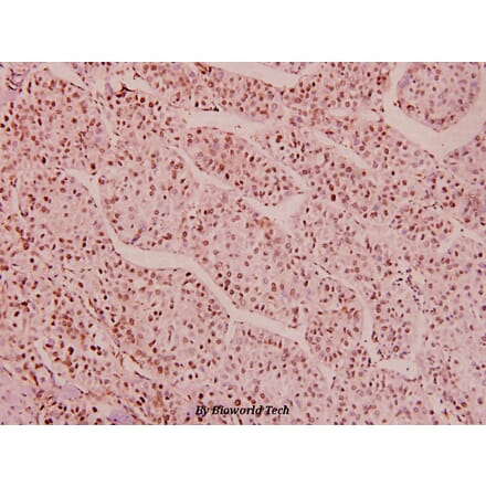 Anti-HDAC1 (phospho-S421/423) Antibody from Bioworld Technology (BS5077) - Antibodies.com
