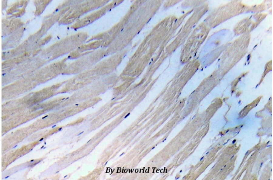 Anti-IKKα/β (phospho-S180/181) Antibody from Bioworld Technology (BS5082) - Antibodies.com