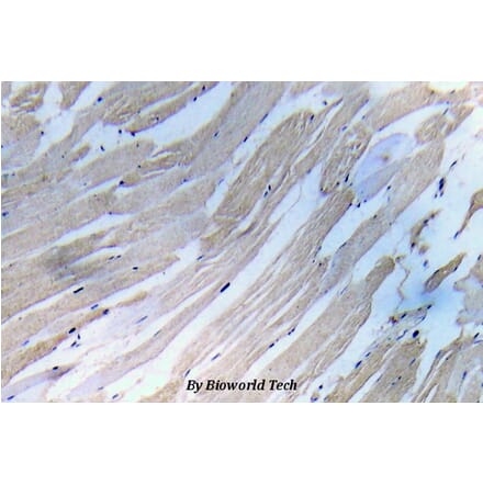 Anti-IKKα/β (phospho-S180/181) Antibody from Bioworld Technology (BS5082) - Antibodies.com