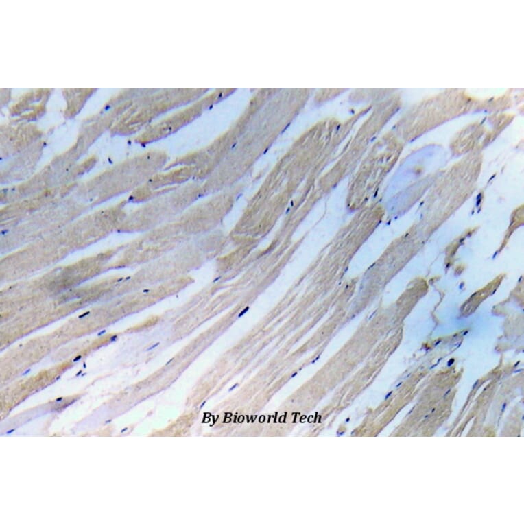 Anti-IKKα/β (phospho-S180/181) Antibody from Bioworld Technology (BS5082) - Antibodies.com