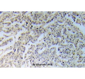 Anti-IKKα/β (phospho-S176) Antibody from Bioworld Technology (BS5083) - Antibodies.com