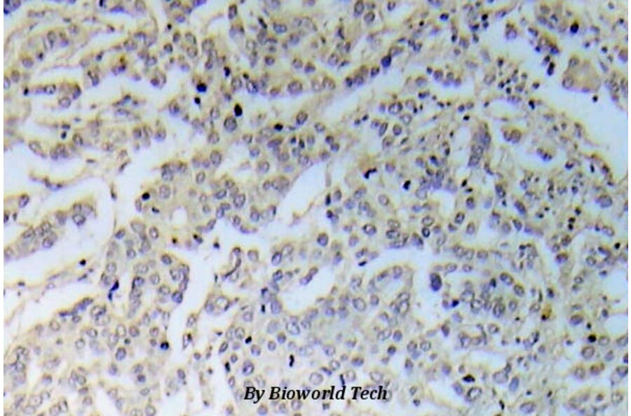 Anti-IKKα/β (phospho-S176) Antibody from Bioworld Technology (BS5083) - Antibodies.com