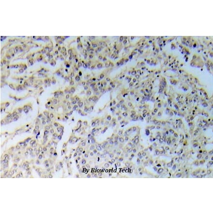 Anti-IKKα/β (phospho-S176) Antibody from Bioworld Technology (BS5083) - Antibodies.com