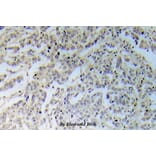 Anti-IKKα/β (phospho-S176) Antibody from Bioworld Technology (BS5083) - Antibodies.com
