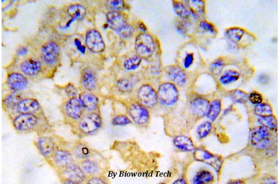 Anti-IRS-1 (phospho-S612) Antibody from Bioworld Technology (BS5084) - Antibodies.com
