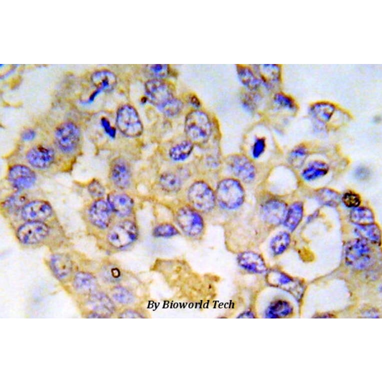 Anti-IRS-1 (phospho-S612) Antibody from Bioworld Technology (BS5084) - Antibodies.com