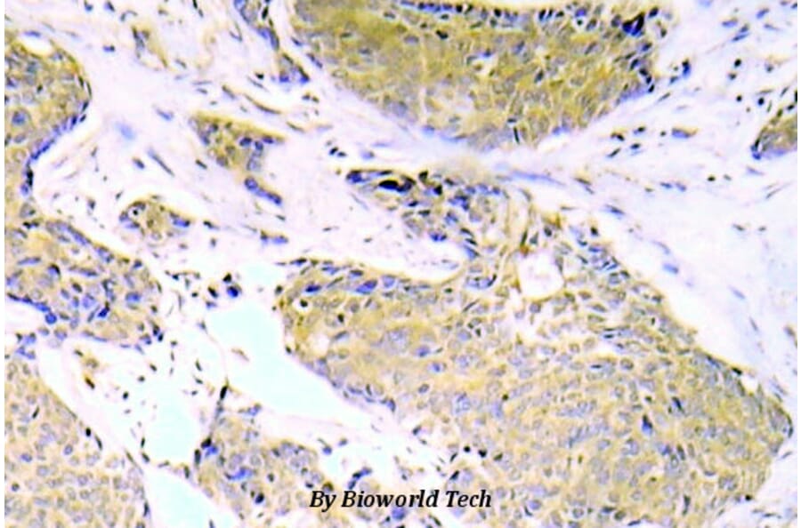 Anti-NFkB-p65 (phospho-S536) Antibody from Bioworld Technology (BS5088) - Antibodies.com