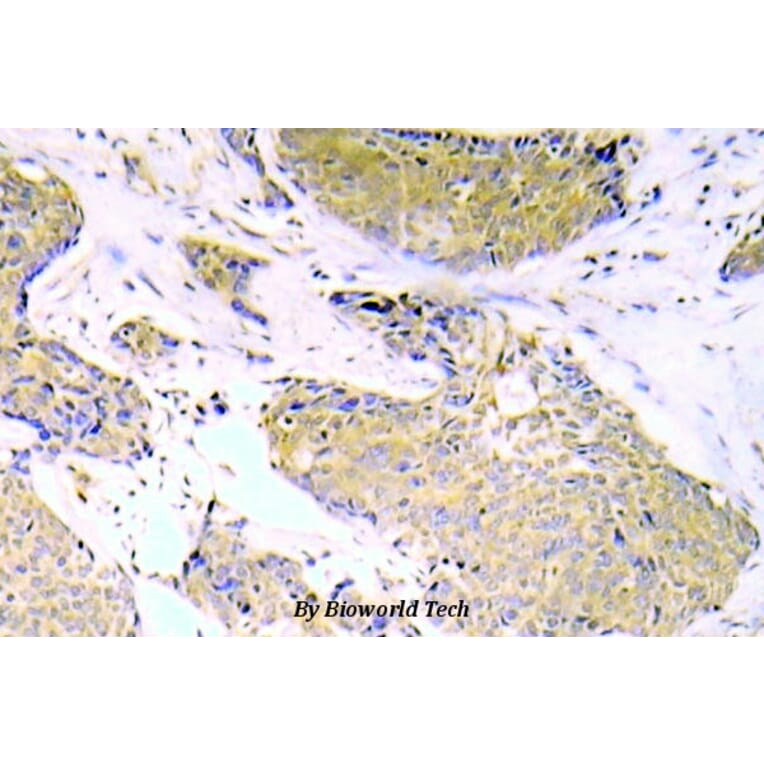 Anti-NFkB-p65 (phospho-S536) Antibody from Bioworld Technology (BS5088) - Antibodies.com