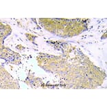 Anti-NFkB-p65 (phospho-S536) Antibody from Bioworld Technology (BS5088) - Antibodies.com