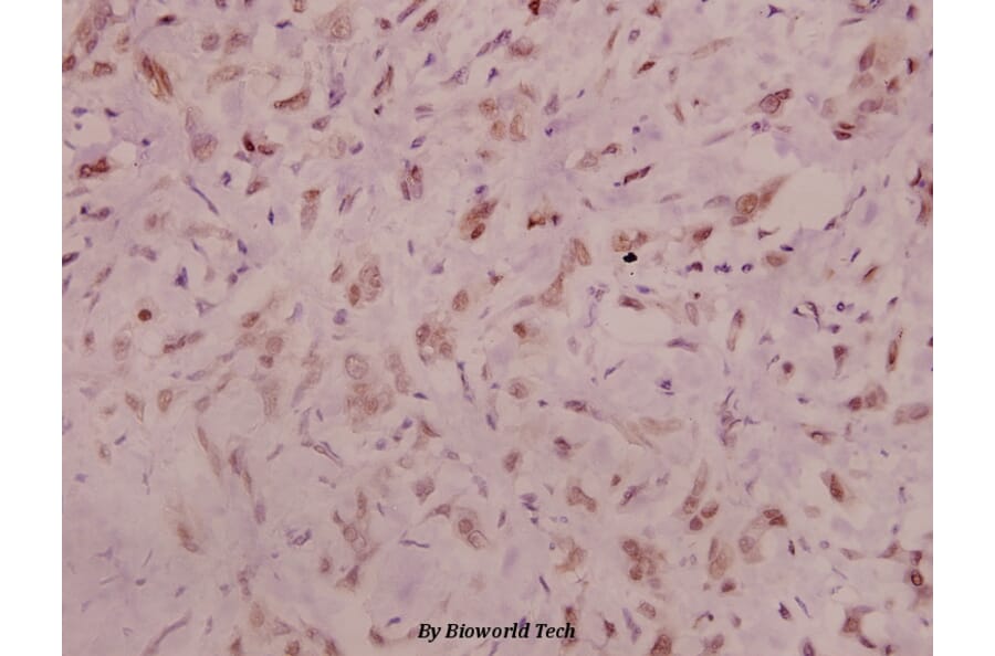Anti-NMDAζ1 (phospho-S896) Antibody from Bioworld Technology (BS5090) - Antibodies.com