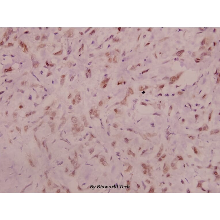 Anti-NMDAζ1 (phospho-S896) Antibody from Bioworld Technology (BS5090) - Antibodies.com