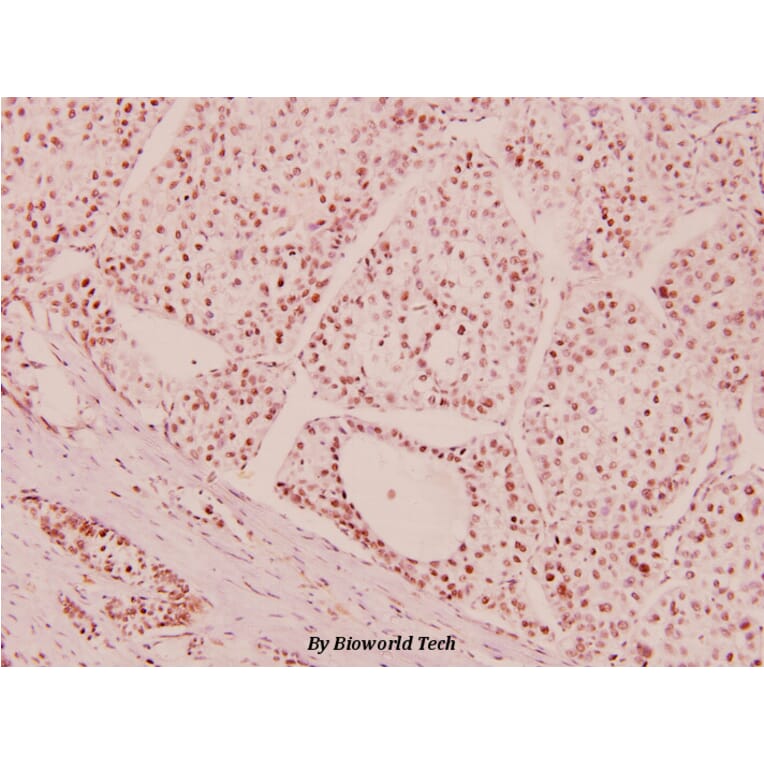 Anti-ATM (I1987) Antibody from Bioworld Technology (BS5505) - Antibodies.com