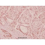 Anti-ATM (I1987) Antibody from Bioworld Technology (BS5505) - Antibodies.com