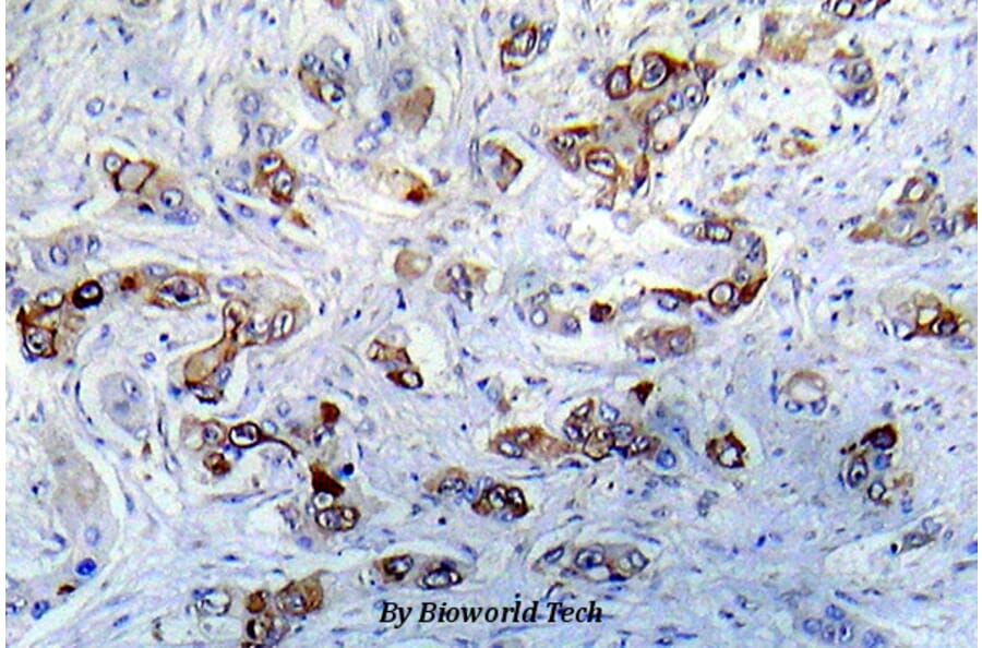 Anti-CaMKIIα (K292) Antibody from Bioworld Technology (BS5510) - Antibodies.com