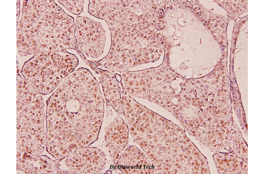 Anti-P53 (D43) Antibody from Bioworld Technology (BS5529) - Antibodies.com