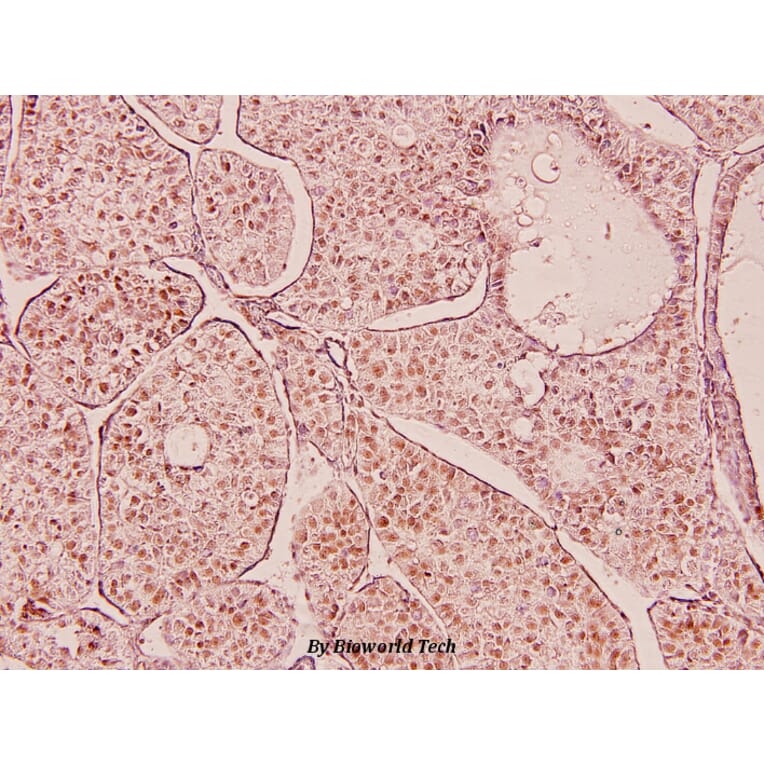 Anti-P53 (D43) Antibody from Bioworld Technology (BS5529) - Antibodies.com